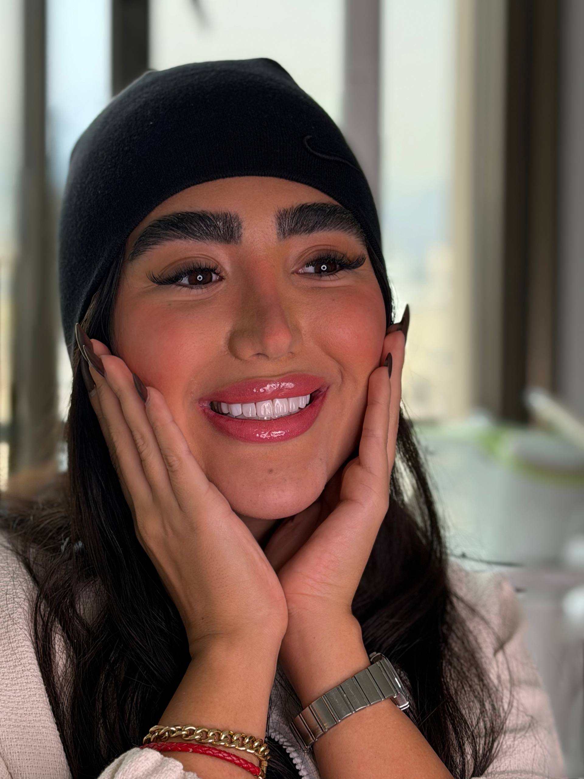 نتیجه کامپوزیت دندان